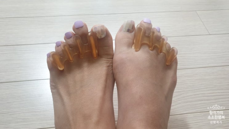  무지외반증교정기로 나의 소중한 발 관리를 해보아요