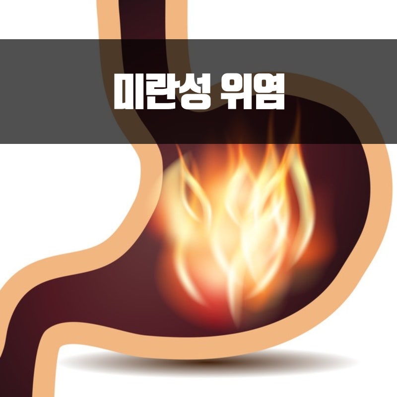 미란성 위염 때문에 포함되어 있습니다. 4
