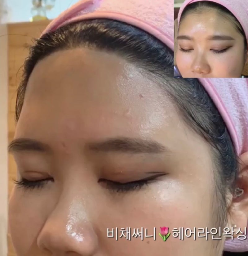 대구헤어라인교정 고민이시라면 리얼테스트로 가보세요 7