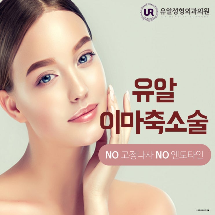  이마축소후기 대량 보유하고 있는 유알
