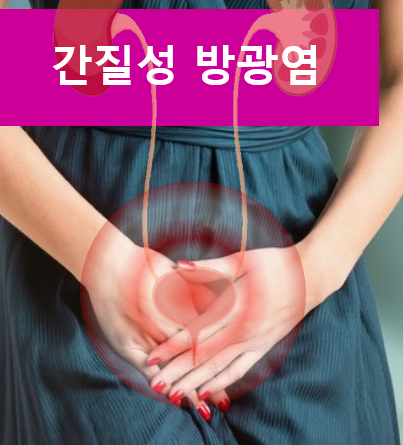  [울산 비뇨기과] 간질성 방광염의 원인, 증상, 검사, 치료