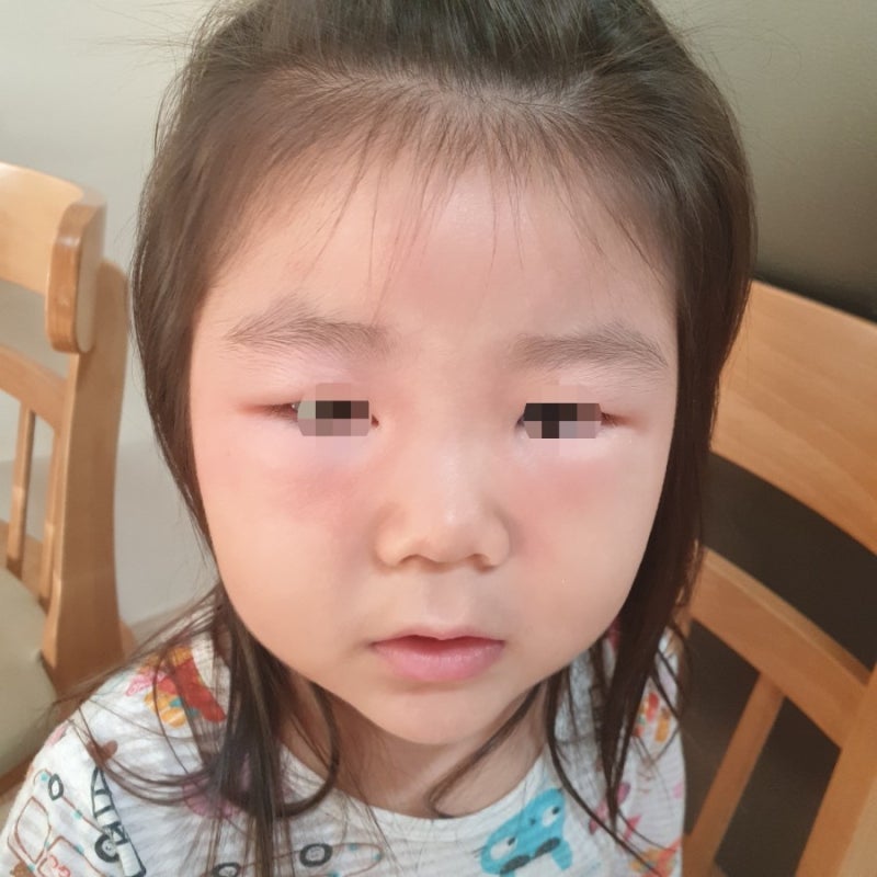 김포 운양동 아이클 소아과에서 돌아기 1