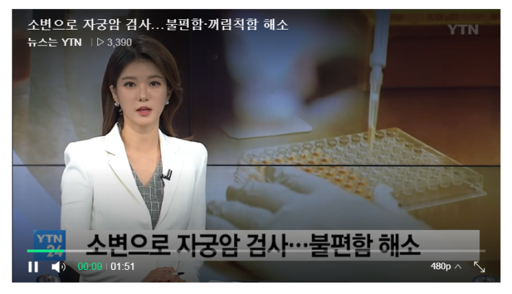  소변으로 자궁암 검사...불편함·꺼림칙함 해소