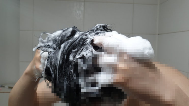  두피진정 시키고싶은데 머리가가려워요