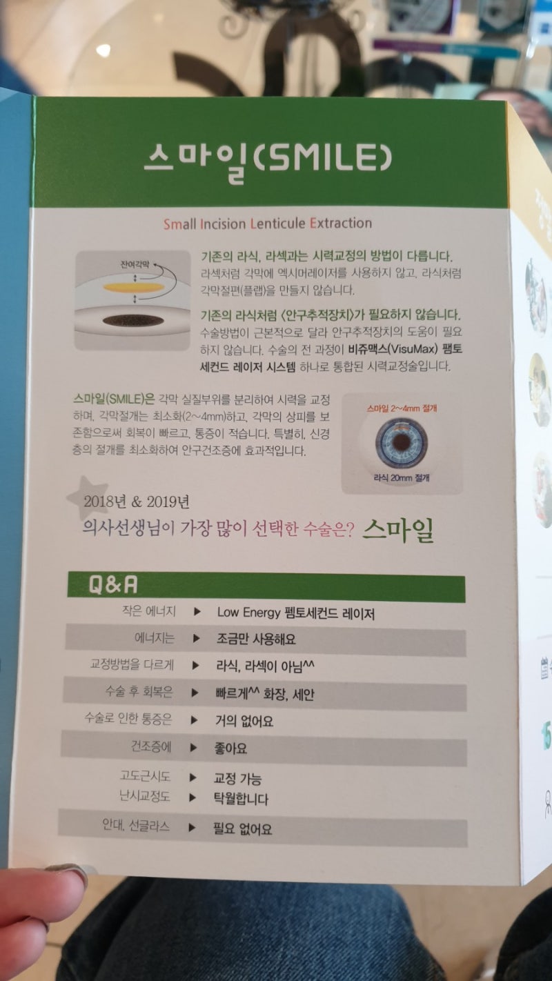 대구 메트로안과 라식 스마일라식 수술전 검사 후기