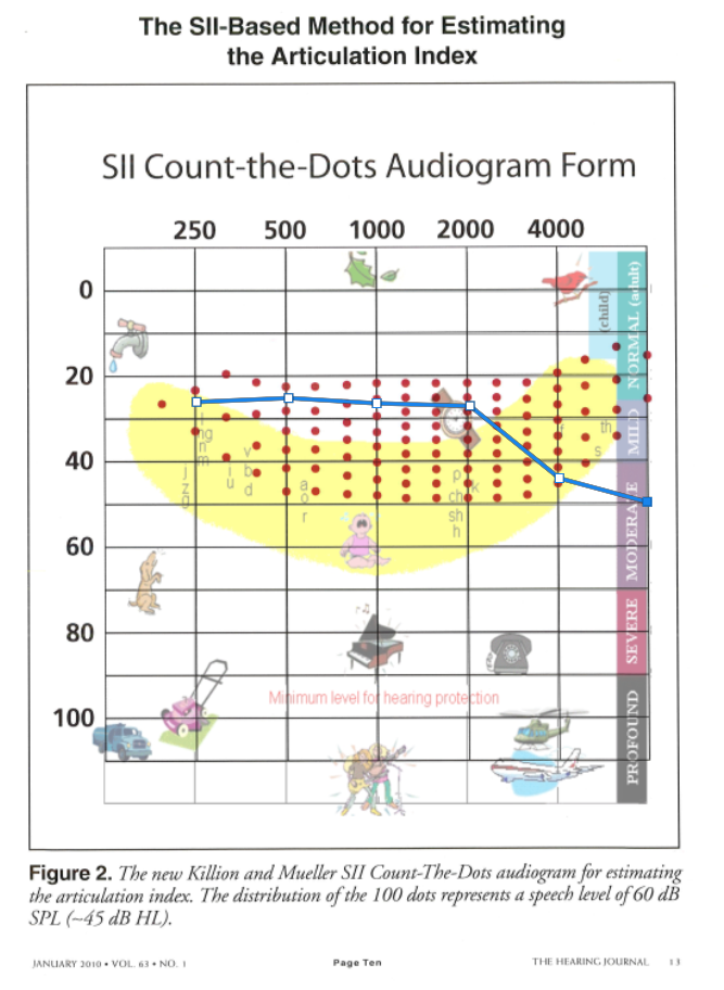 보청기평가 및 적합 : 1 소리 및 청각손실 이해