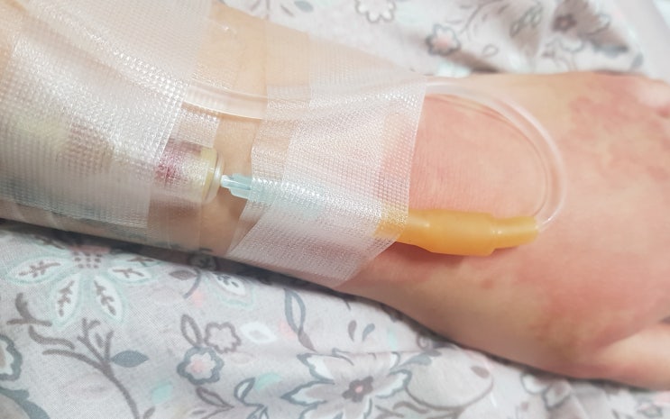  오랜만에 쓰는 나의 근황 <부제-두드러기와의 사투>