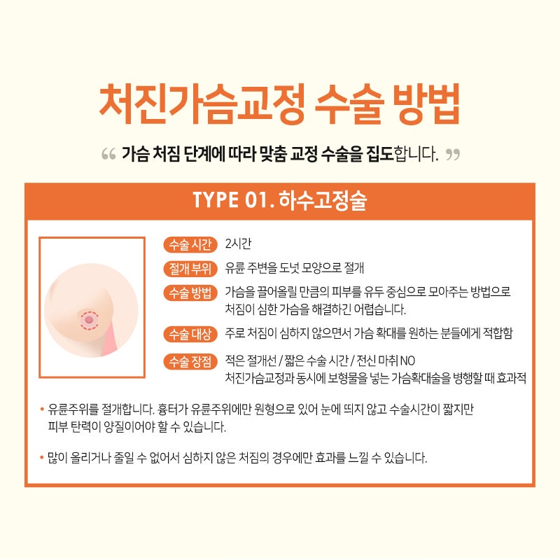처진 가슴 수술에 대한 걱정을 줄이기 위해
