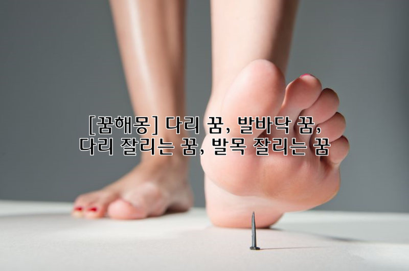 [꿈해몽] 다리 꿈, 발바닥 꿈, 다리 잘리는 꿈, 발목 잘리는 꿈