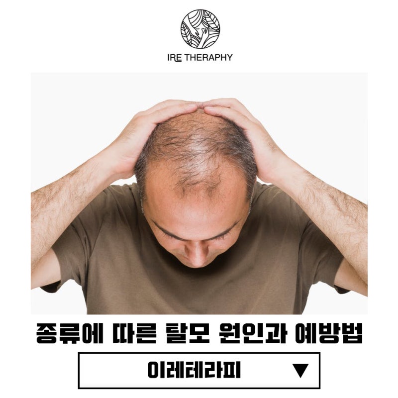 탈모원인/증상/탈모예방법까지 한번에 알아본다 6