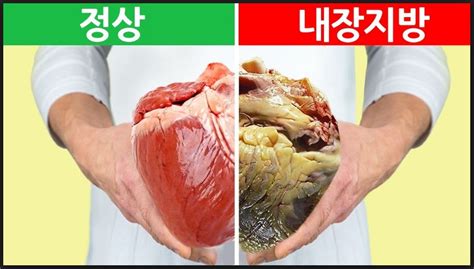  내장지방 자가진단 테스트