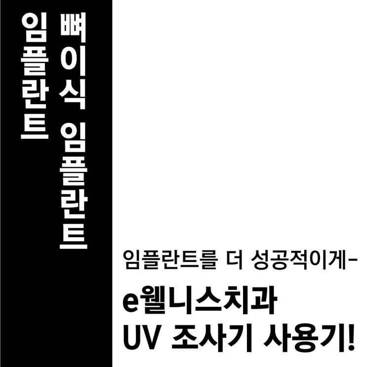 임플란트/뼈이식 임플란트 전문치과 UV 조사기 사용기!