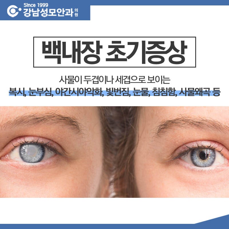 빛 번짐, 흐릿함, 안구건조증_노안과 백내장 초기 증상 차이 - 쇼크