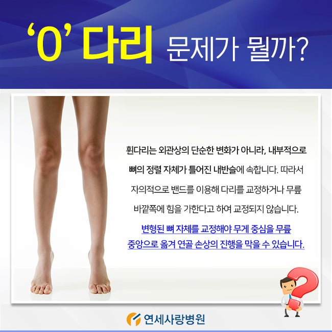 당신은 그것을 바로 잡기 위해 뒤에 무엇이 있는지 알아야합니다