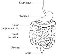  LADG (Laparoscopy assisted distal gastrectomy)