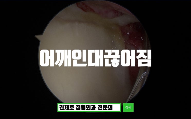  어깨인대끊어짐 돌아누울때