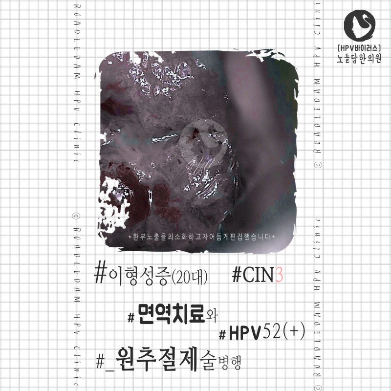 자궁경부이형성증 증상의 근본 원인을 해결하는 면역치료 6