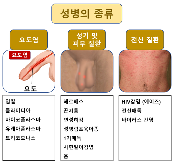 남자 성병의 종류와 진단/검사 방법