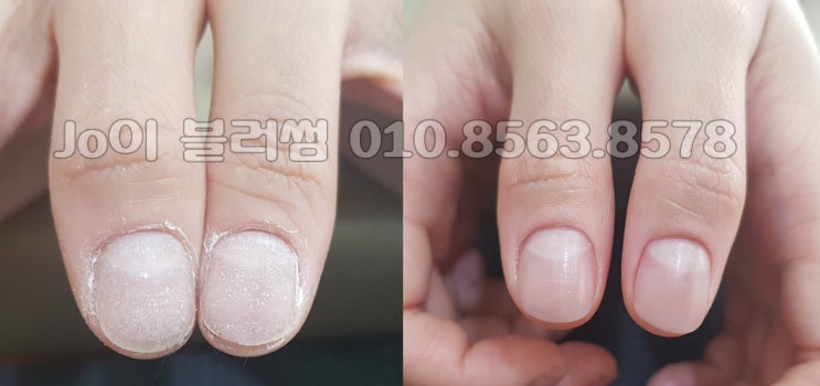  용인 손톱이 자라지 않아서, 손톱이 찌그러져서, 손톱이 두꺼워져서 고민하시는 고객님들을 기다리는 네일샵 조이블러썸