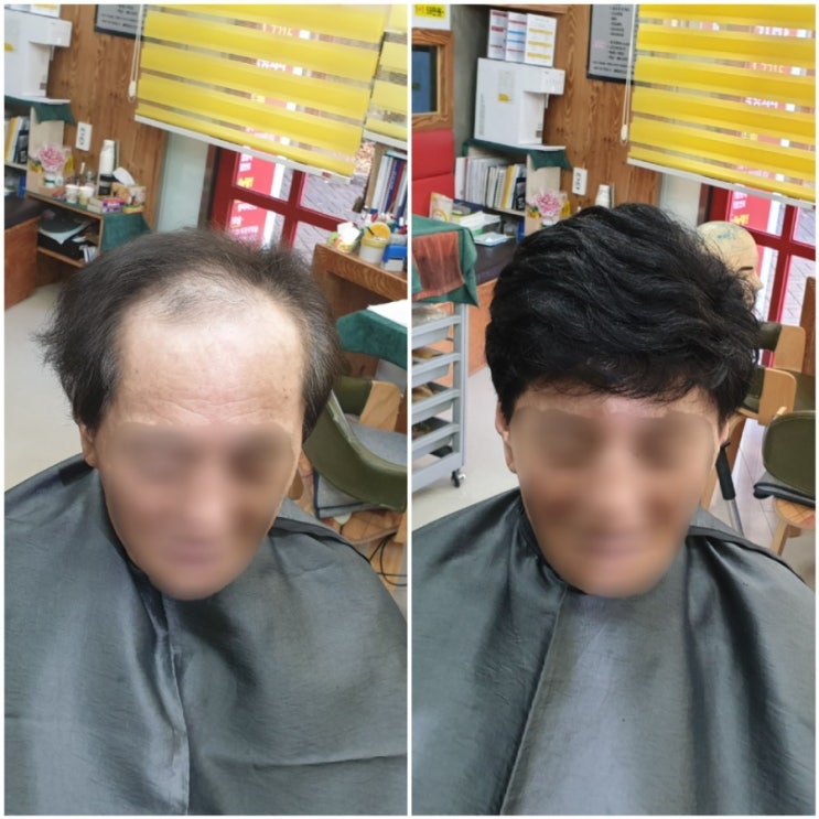  춘천맞춤가발 피팅하는 날~^^