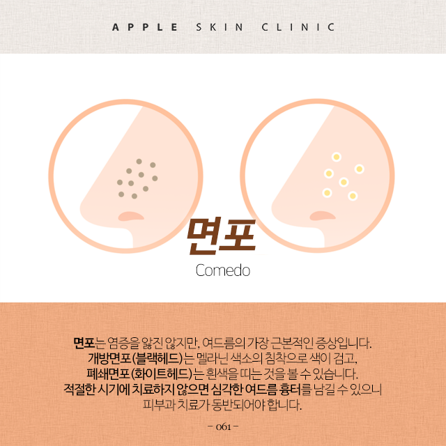 의학칼럼 용어사전 061 - 면포 : Comedo : 네이버 블로그