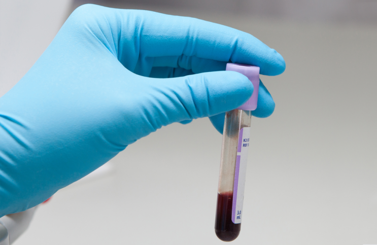 면역 시스템의 보병 부대 '백혈구', 이상적인 수치는? 다음 혈액 검사 시 꼭 확인하자!