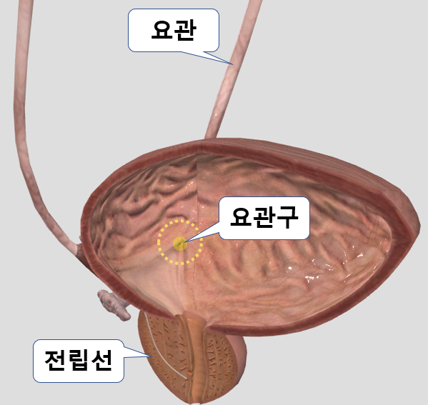  전립선 비대증이 심해지면 신장이 망가지는 이유