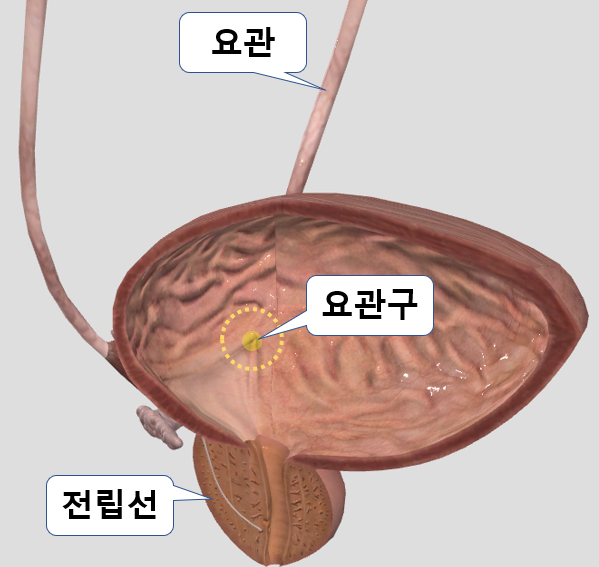 전립선 비대증이 심해지면 신장이 망가지는 이유