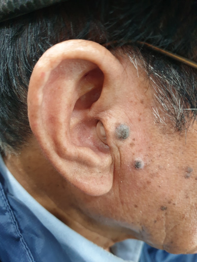 제주보청기 실속있게 고른 이유 5