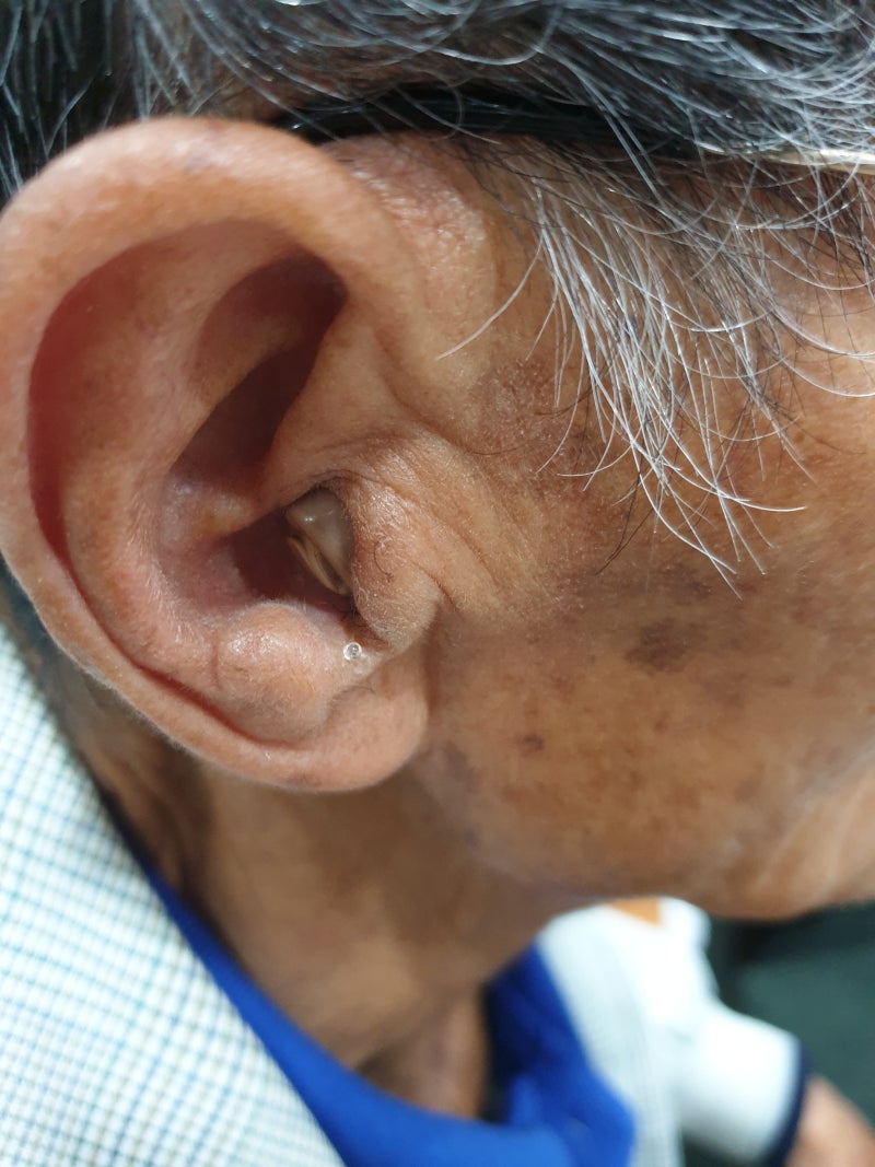 제주보청기 실속있게 고른 이유 4