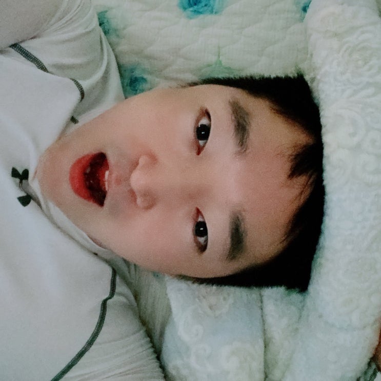  수원 안면비대칭 침맞으러 턱관절교정 하고 왔어요