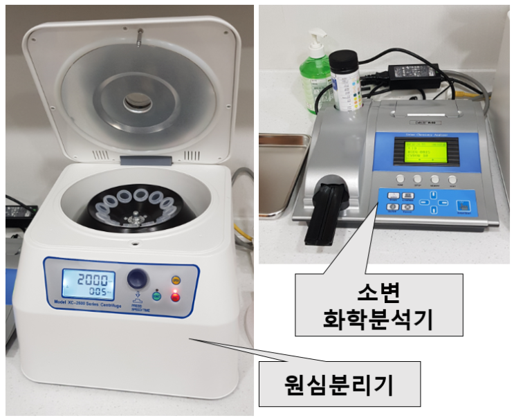 비뇨기과에서 당일 소변 검사가 가능한 이유