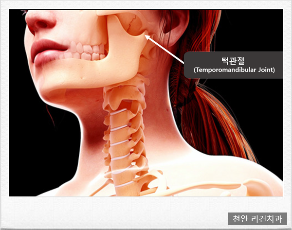  천안서북구치과에서 턱관절 장애에 대해 알려드릴게요! - 알쓸재치