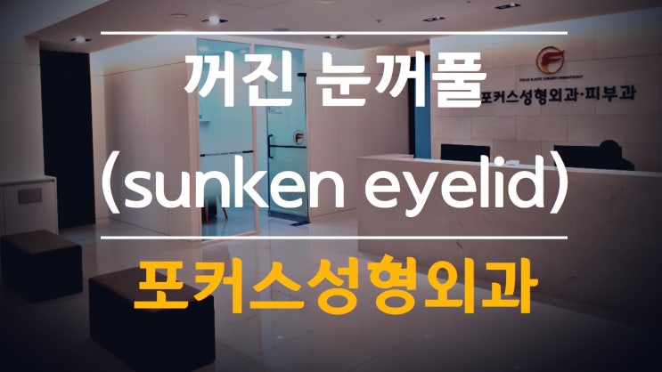 꺼진 눈꺼풀(sunken eyelid) 치료 - 포커스성형외과