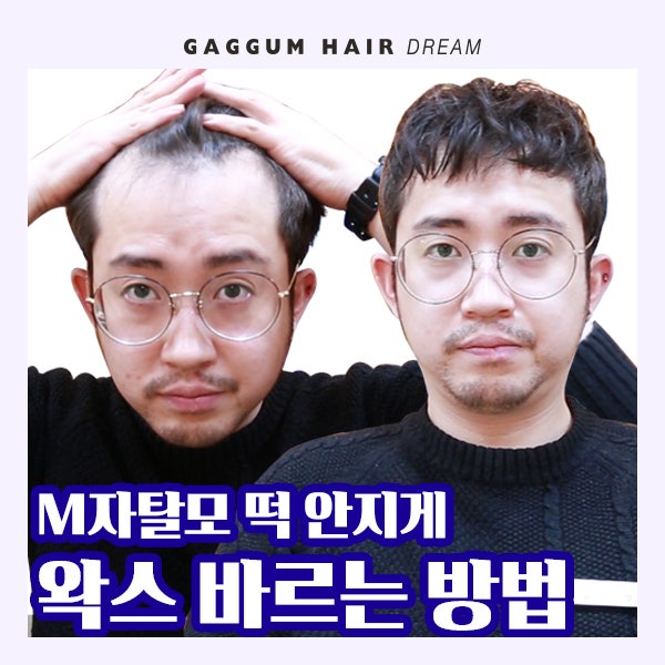 일산왁스탈모/브라질리언왁스는 주엽왁스탈모샵 안녕하세요 뷰티추천