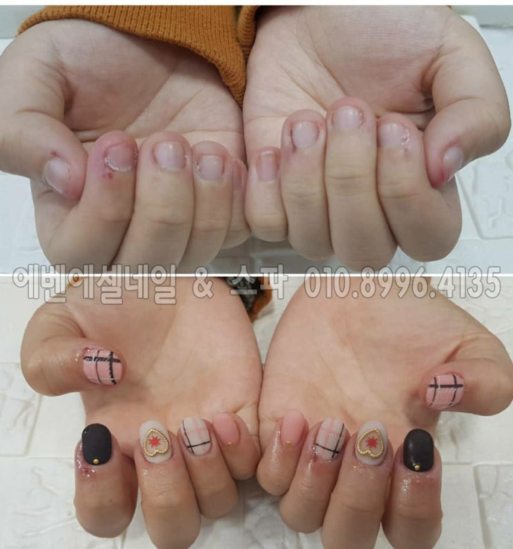  안산 물어뜯는 손톱, 발톱으로 인한 변형 관리 무독성레진젤이라서 더욱 믿음이 가는 네일샵 에벤에셀 네일 & 스파