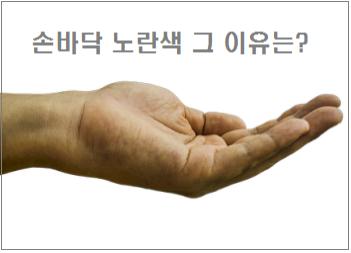  손바닥 노란색 그 이유는