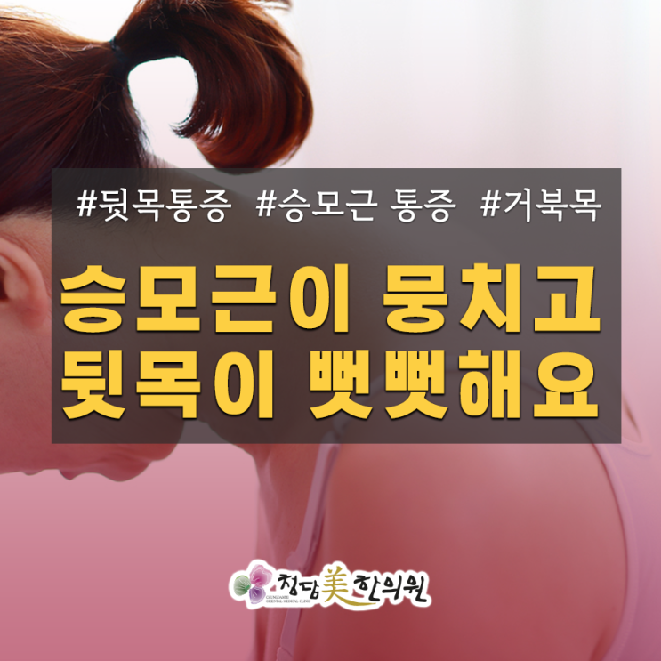 뒷목이 뻐근한 증상 그냥 둬도 될까요? / 승모근통증, 어깨통증 바로알기 뒷목이 뻐근한 증상 그냥 둬도 될까요? / 승모근통증, 어깨통증 바로알기