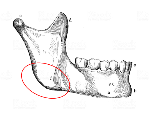  윤곽수술> 사각턱 수술(Mandibuloplasty)은?