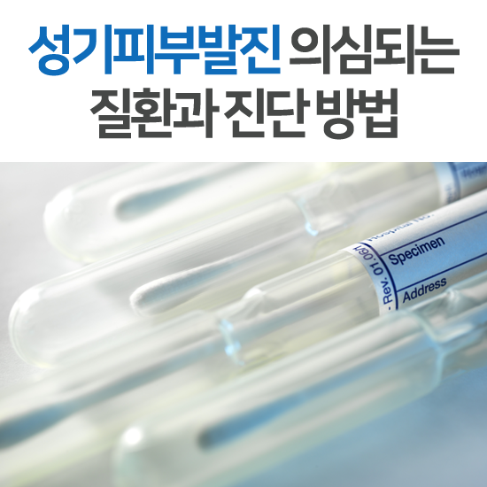 성기피부발진 증상(두드러기 및 종기, 통증, 가려움)과 진단 : 네이버 블로그 성기피부발진 증상(두드러기 및 종기, 통증, 가려움)과 진단 : 네이버 블로그