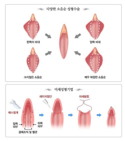 관계후 질입구 부음 계속되는 이유 : 네이버 블로그 관계후 질입구 부음 계속되는 이유 : 네이버 블로그