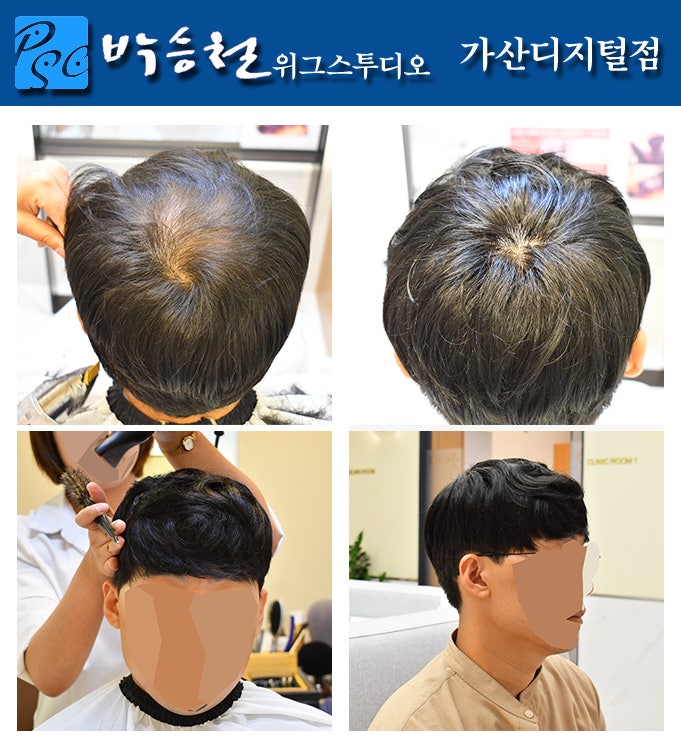 남자정수리가발 완전 착한가격에 품질도
