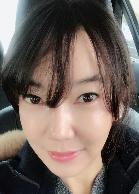  얼굴실리프팅비용 선택하길 잘했어