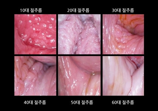 테크닉 섹스 54 - 그녀의 몸(질주름과 돌기) : 네이버 블로그 테크닉 섹스 54 - 그녀의 몸(질주름과 돌기) : 네이버 블로그