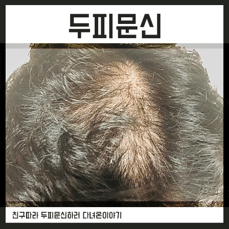  울산두피문신 친구 따라 비본에 다녀왔네요.