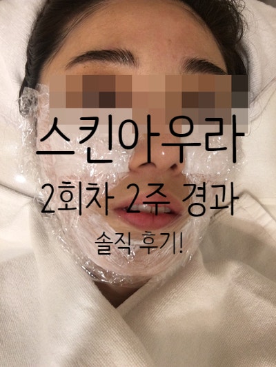 안면 리프팅 고주파 스킨 아우라 리프팅 시술 후기
