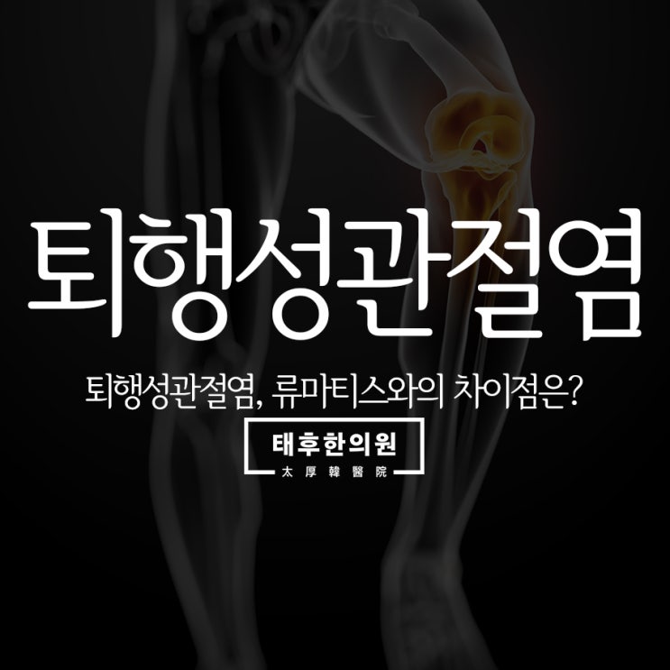  퇴행성관절염, 류마티스와의 차이점은?