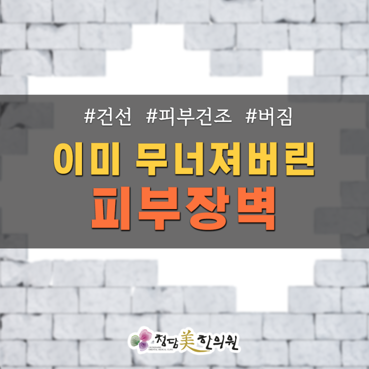 장시간 반신욕이 건선을 부른다?! 장시간 반신욕이 건선을 부른다?!