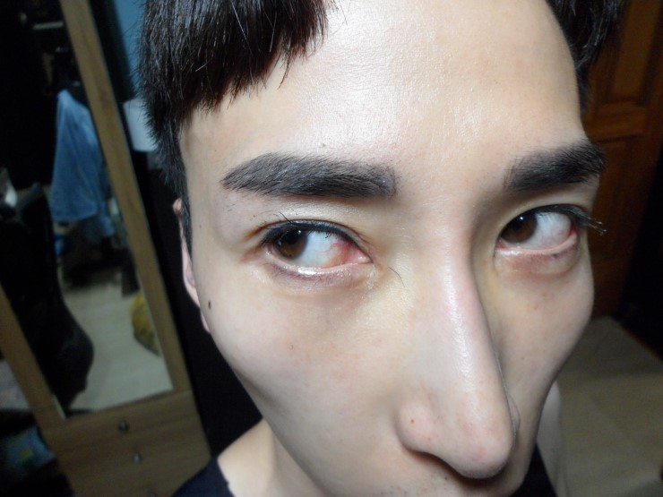 남성 수염 발모제 수염을 기르다 마이크로겐 턱수염 발모제 눈썹도 가능