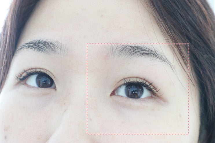  홈쇼핑 쌍꺼풀레이스 EYELID LACE 아이리드 레이스 내돈내사 리얼 후기 (엄청난 짝눈)